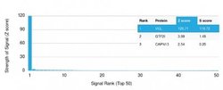 Vinculin, Mouse anti-Human,Mouse, Clone: VCL/2573, Novus Biologicals 20